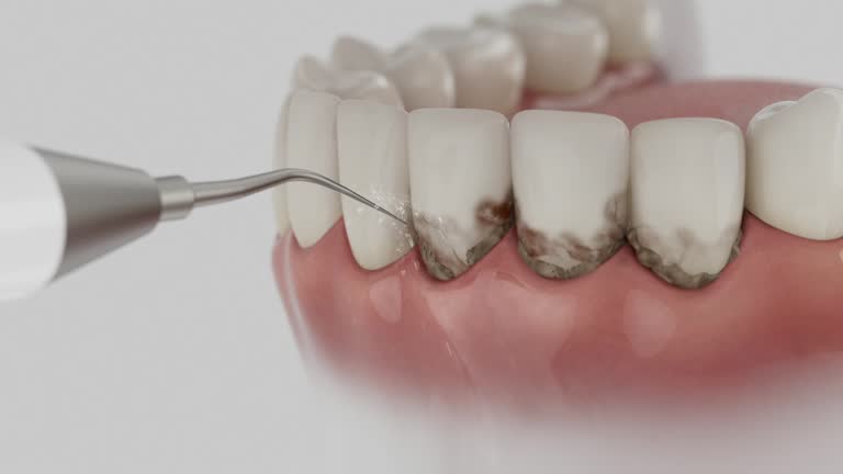 Reliable Dental Implants contractor in Salem, OH by Smile Center Dentistry
